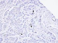 Immunohistochemistry (Formalin/PFA-fixed paraffin-embedded sections) - Anti-TRPM2 antibody (AB96785)