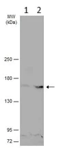 Western blot - Anti-TRPM2 antibody (AB96785)