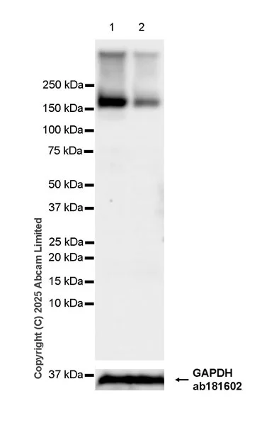 Western blot - Anti-TRPM2 antibody [EPR22476-57] - BSA and Azide free (AB326596)