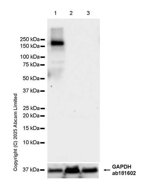 Western blot - Anti-TRPM2 antibody [EPR22476-57] - BSA and Azide free (AB326596)