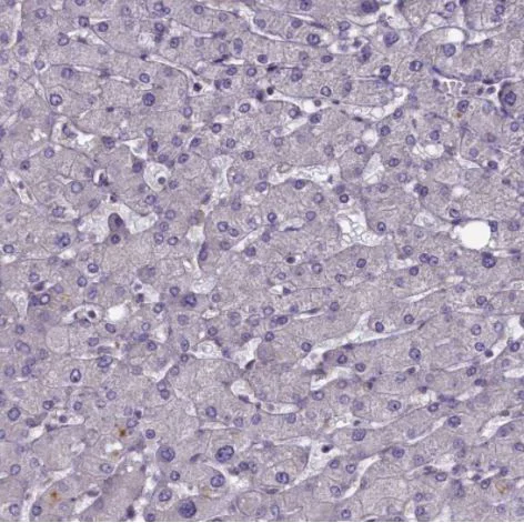 Immunohistochemistry (Formalin/PFA-fixed paraffin-embedded sections) - Anti-TRPM4 antibody (AB247024)