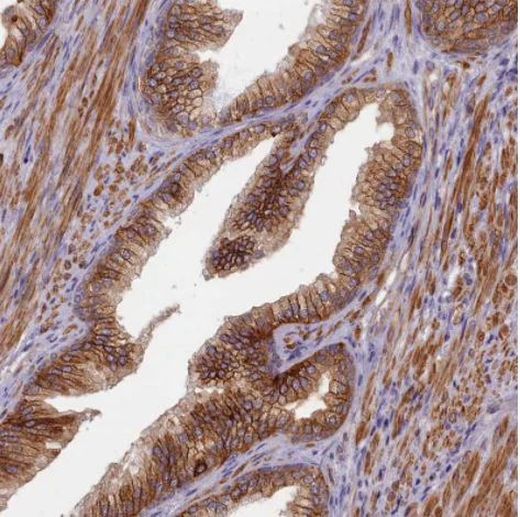 Immunohistochemistry (Formalin/PFA-fixed paraffin-embedded sections) - Anti-TRPM4 antibody (AB247024)