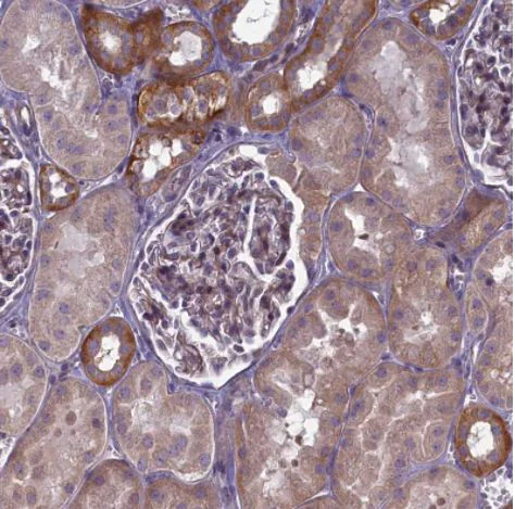 Immunohistochemistry (Formalin/PFA-fixed paraffin-embedded sections) - Anti-TRPM4 antibody (AB247024)