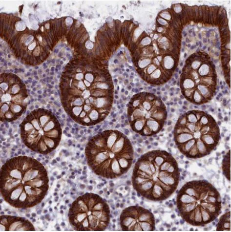 Immunohistochemistry (Formalin/PFA-fixed paraffin-embedded sections) - Anti-TRPM4 antibody (AB247024)
