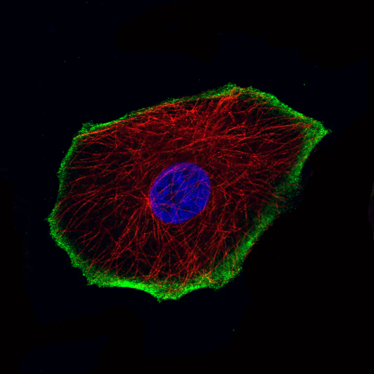 Immunocytochemistry/ Immunofluorescence - Anti-TRPM4 Antibody [CL11214] (AB327132)