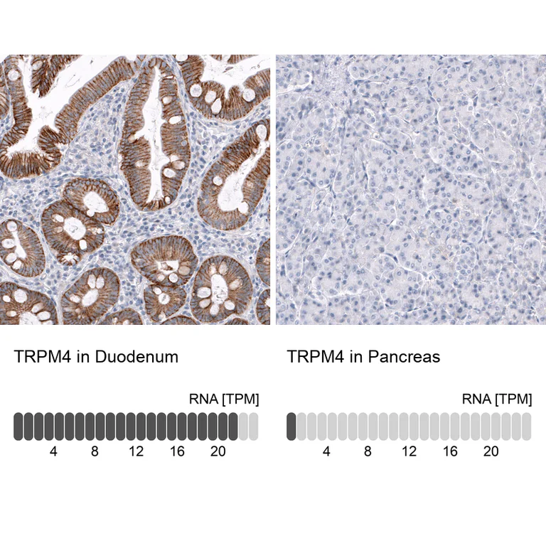 Immunohistochemistry (Formalin/PFA-fixed paraffin-embedded sections) - Anti-TRPM4 Antibody [CL11214] (AB327132)