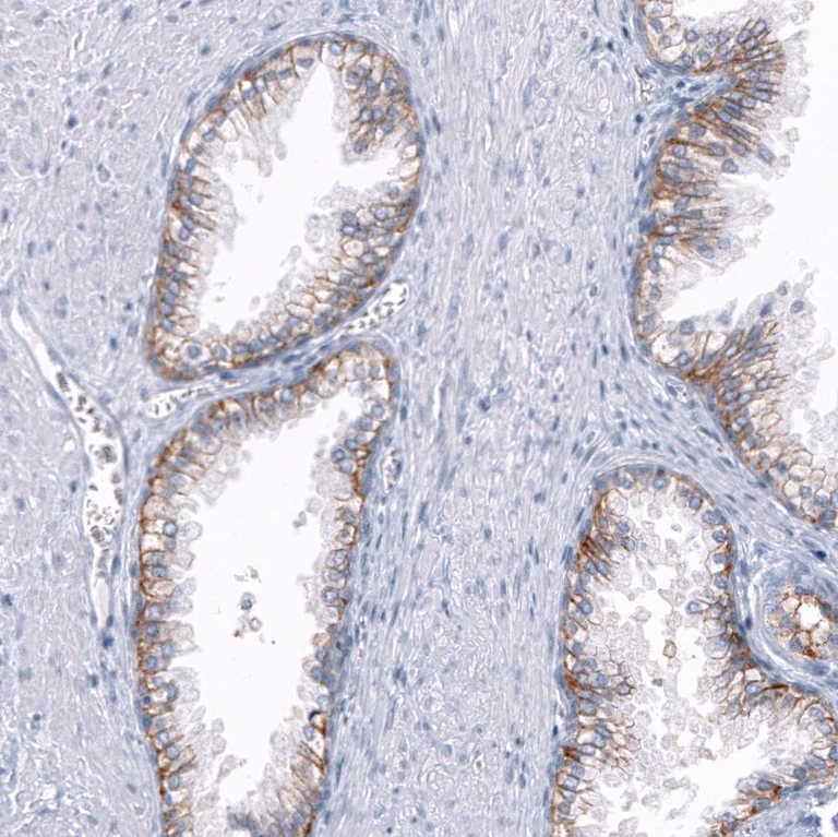Immunohistochemistry (Formalin/PFA-fixed paraffin-embedded sections) - Anti-TRPM4 Antibody [CL11214] (AB327132)