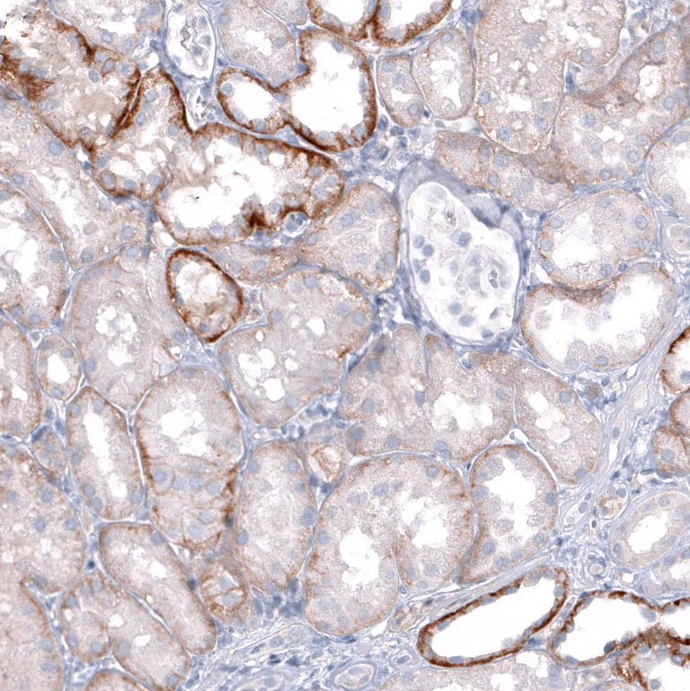 Immunohistochemistry (Formalin/PFA-fixed paraffin-embedded sections) - Anti-TRPM4 Antibody [CL11214] (AB327132)