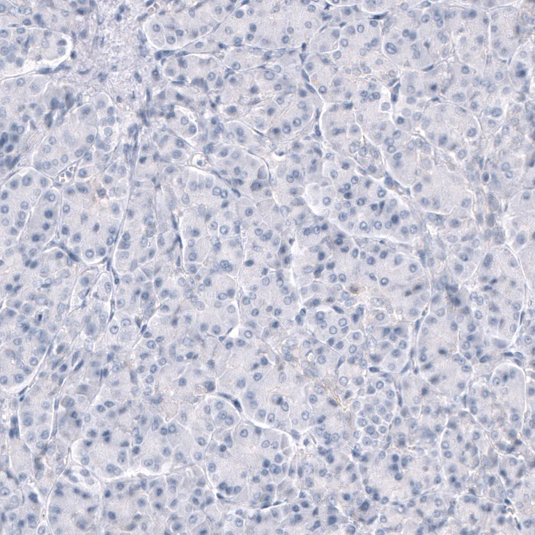 Immunohistochemistry (Formalin/PFA-fixed paraffin-embedded sections) - Anti-TRPM4 Antibody [CL11214] (AB327132)