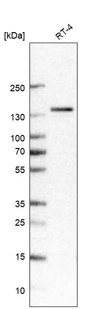Western blot - Anti-TRPM4 Antibody [CL11214] (AB327132)