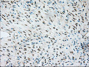 Immunohistochemistry (Formalin/PFA-fixed paraffin-embedded sections) - Anti-TRPM4 antibody [OTI10H5] (AB123936)
