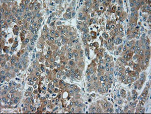 Immunohistochemistry (Formalin/PFA-fixed paraffin-embedded sections) - Anti-TRPM4 antibody [OTI10H5] (AB123936)