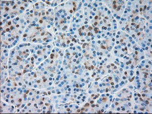 Immunohistochemistry (Formalin/PFA-fixed paraffin-embedded sections) - Anti-TRPM4 antibody [OTI10H5] (AB123936)