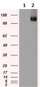 Western blot - Anti-TRPM4 antibody [OTI10H5] (AB123936)