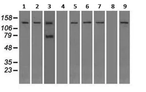 Western blot - Anti-TRPM4 antibody [OTI10H5] (AB123936)