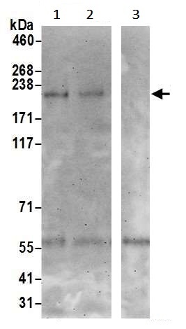 Immunoprecipitation - Anti-TRPM7 antibody (AB245408)