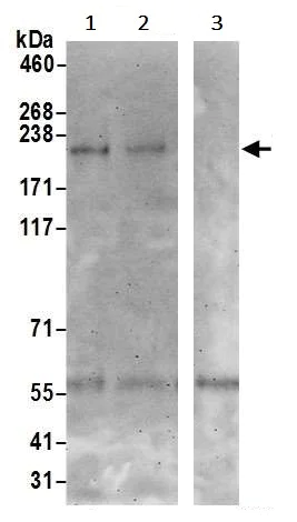 Immunoprecipitation - Anti-TRPM7 antibody (AB245408)