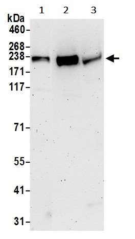 Western blot - Anti-TRPM7 antibody (AB245408)