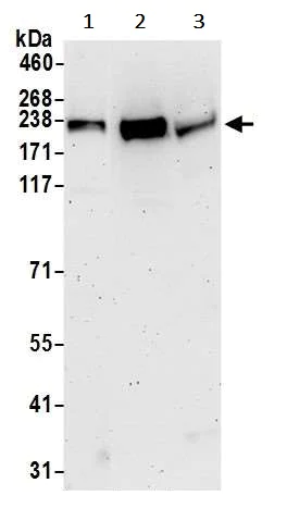 Western blot - Anti-TRPM7 antibody (AB245408)