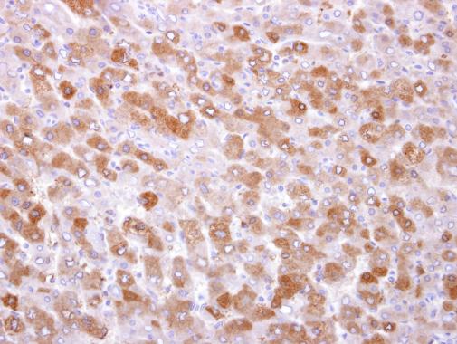 Immunohistochemistry (Formalin/PFA-fixed paraffin-embedded sections) - Anti-TRPM7 antibody (AB262698), expandable thumbnail