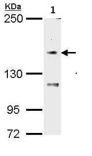 Western blot - Anti-TRPM7 antibody (AB262698), expandable thumbnail