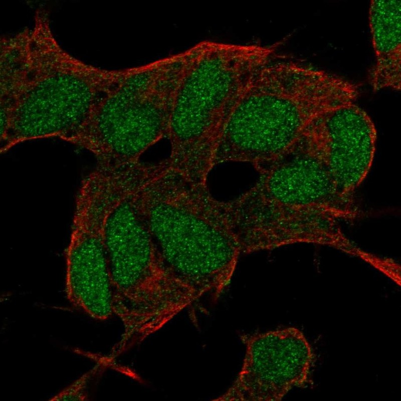 Immunocytochemistry/ Immunofluorescence - Anti-TRPM7 antibody (AB262909)