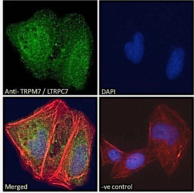 Immunocytochemistry/ Immunofluorescence - Anti-TRPM7 antibody (AB729)