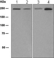 Western blot - Anti-TRPM7 + TRPM6 antibody [EPR4582] (AB109438)