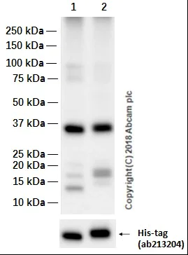 Western blot - Anti-TRPM7 + TRPM6 antibody [EPR4582] (AB109438)