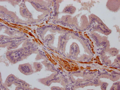 Immunohistochemistry (Formalin/PFA-fixed paraffin-embedded sections) - Anti-TRPM8 antibody [2G7] (AB314169)