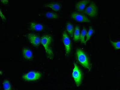 Immunocytochemistry/ Immunofluorescence - Anti-TRPM8 antibody (AB235890)