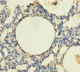 Immunohistochemistry (Formalin/PFA-fixed paraffin-embedded sections) - Anti-TRPM8 antibody (AB235890)