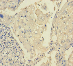 Immunohistochemistry (Formalin/PFA-fixed paraffin-embedded sections) - Anti-TRPM8 antibody (AB235890)
