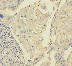 Immunohistochemistry (Formalin/PFA-fixed paraffin-embedded sections) - Anti-TRPM8 antibody (AB235890)