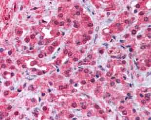 Immunohistochemistry (Formalin/PFA-fixed paraffin-embedded sections) - Anti-TRPM8 antibody (AB3243)