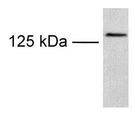 Western blot - Anti-TRPM8 antibody (AB3243)