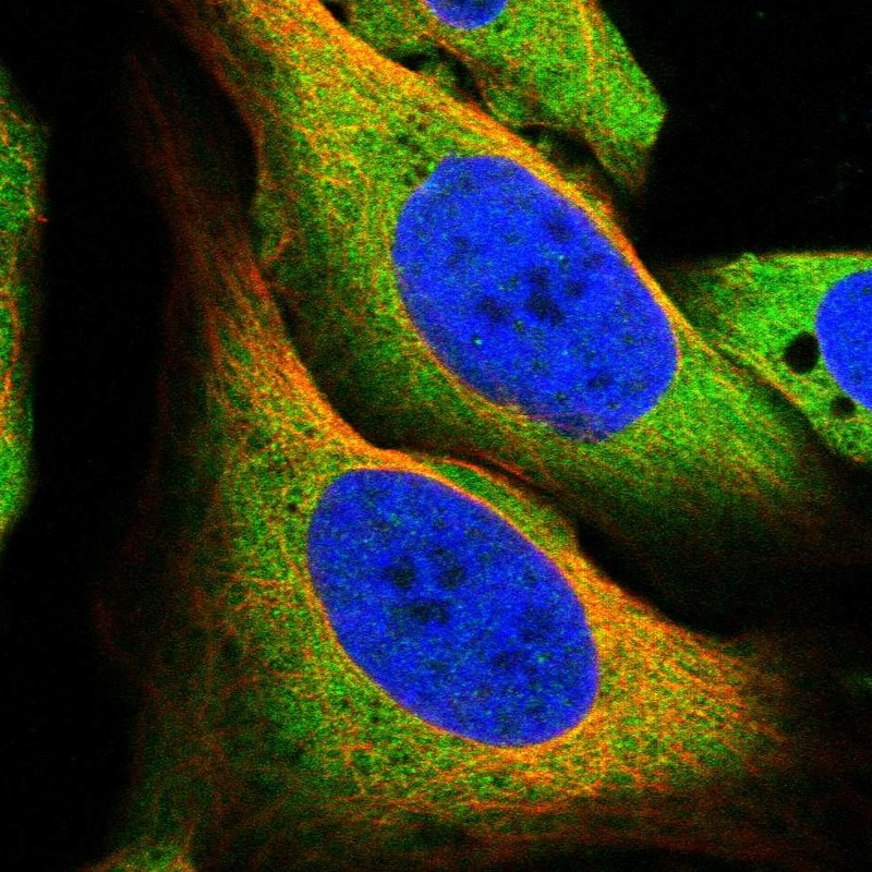 Immunocytochemistry/ Immunofluorescence - Anti-TRPML1/MG-2 antibody (AB272608)