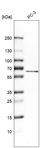 Western blot - Anti-TRPML1/MG-2 antibody (AB272608)