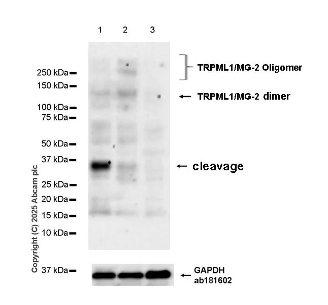 Western blot - Anti-TRPML1/MG-2 antibody [EPR28651-127] (AB323642)