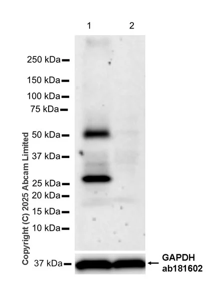 Western blot - Anti-TRPML1/MG-2 antibody [EPR28651-127] (AB323642)