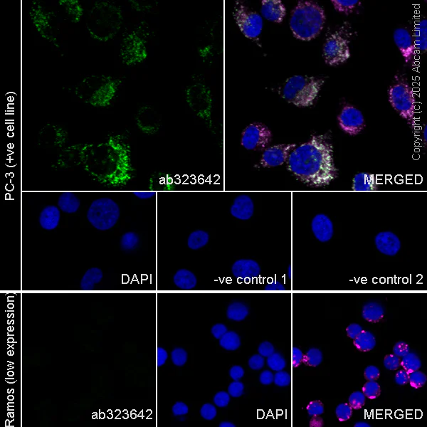 Immunocytochemistry/ Immunofluorescence - Anti-TRPML1/MG-2 antibody [EPR28651-127] - BSA and Azide free (AB325960)