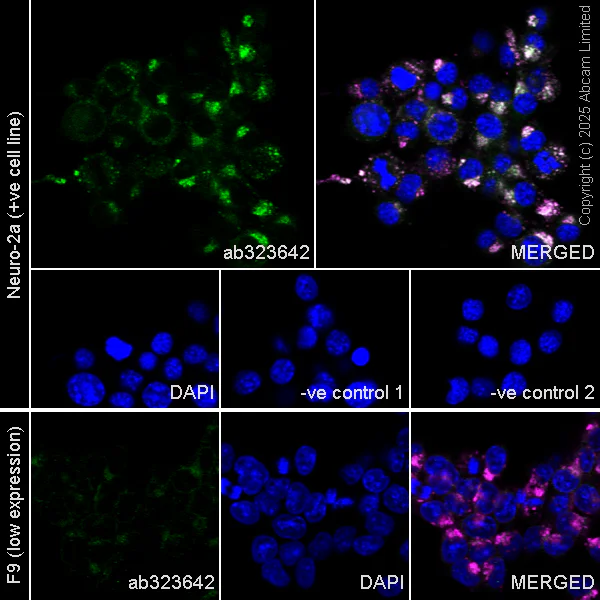 Immunocytochemistry/ Immunofluorescence - Anti-TRPML1/MG-2 antibody [EPR28651-127] - BSA and Azide free (AB325960)