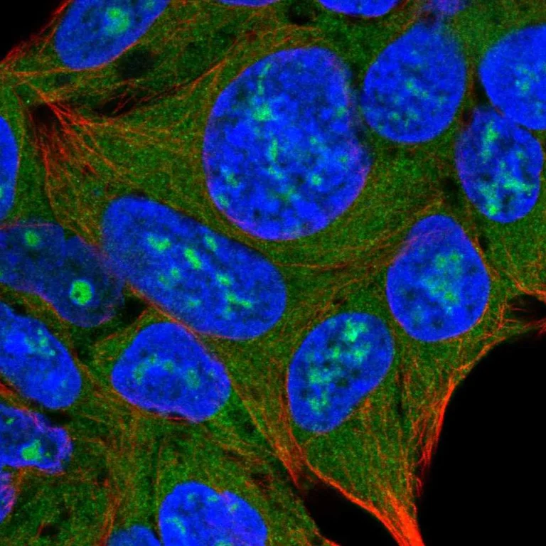 Immunocytochemistry/ Immunofluorescence - Anti-TRPML3 antibody (AB272579)