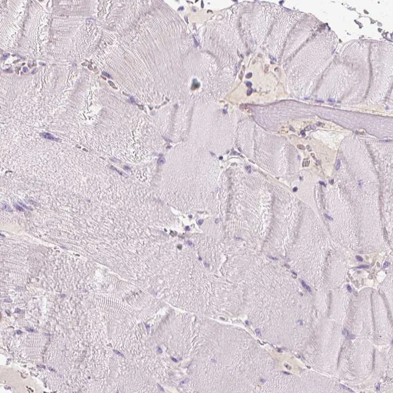 Immunohistochemistry (Formalin/PFA-fixed paraffin-embedded sections) - Anti-TRPML3 antibody (AB272579)