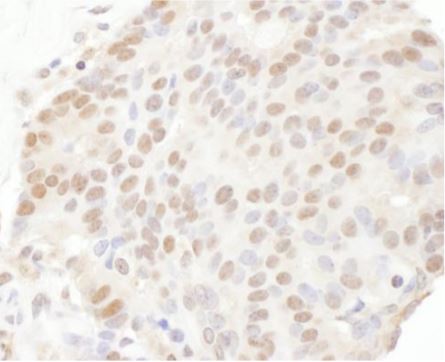 Immunohistochemistry (Formalin/PFA-fixed paraffin-embedded sections) - Anti-TRPS1 antibody (AB125197), expandable thumbnail