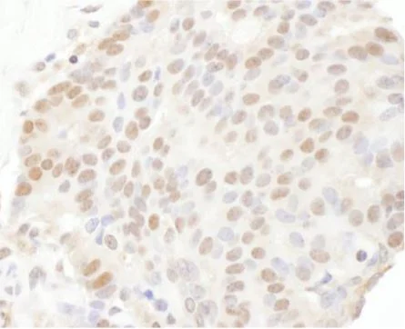 Immunohistochemistry (Formalin/PFA-fixed paraffin-embedded sections) - Anti-TRPS1 antibody (AB125197)