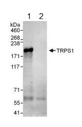 Immunoprecipitation - Anti-TRPS1 antibody (AB125197), expandable thumbnail