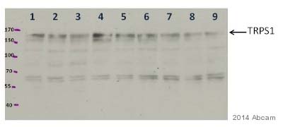Western blot - Anti-TRPS1 antibody (AB125197), expandable thumbnail
