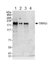 Western blot - Anti-TRPS1 antibody (AB125197), expandable thumbnail