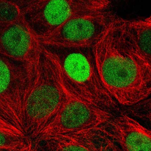 Immunocytochemistry/ Immunofluorescence - Anti-TRPS1 antibody (AB221118), expandable thumbnail